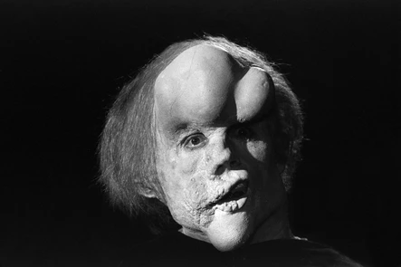 Человек-слон